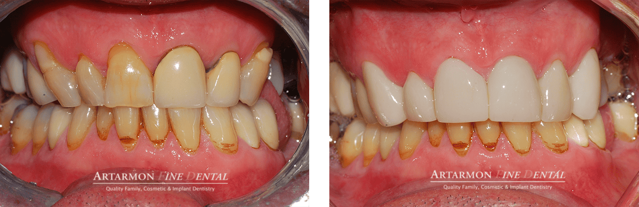 Artarmon Fine Dental logo